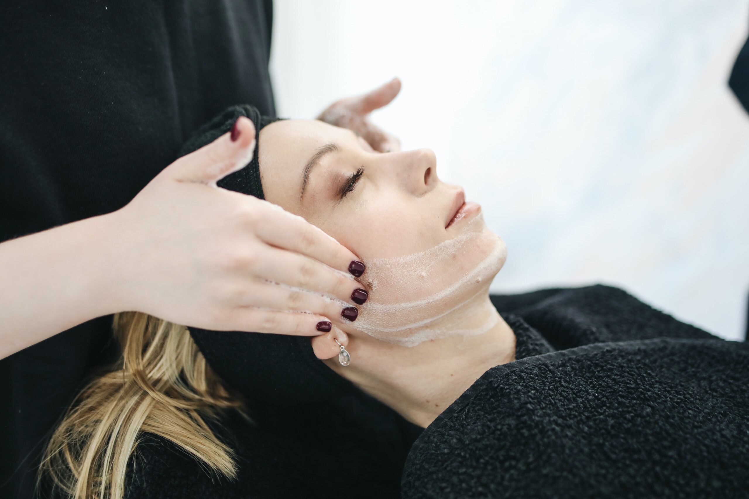 4 Reasons to Consider a Chemical Peel