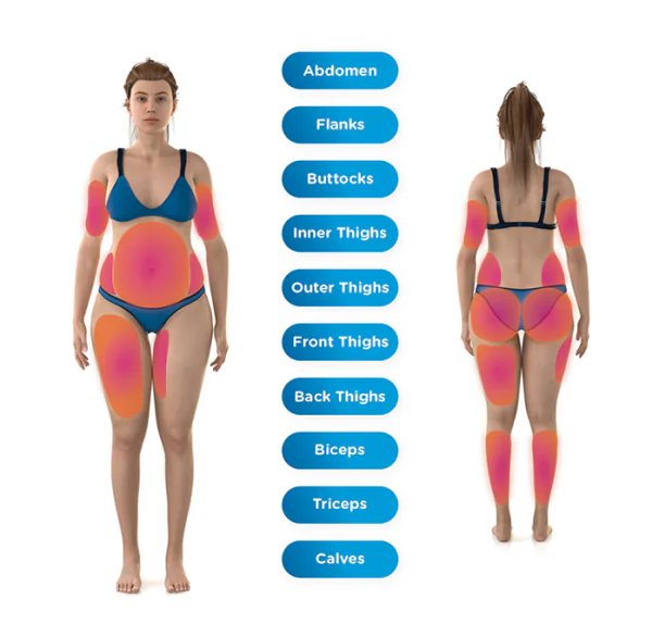 Ten body areas EMSCULPT neo can treat at SANTÉ Aesthetics & Wellness in Portland, Oregon.